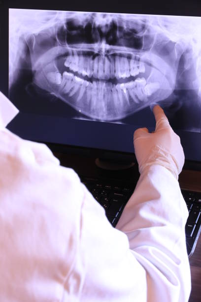 Best Emergency Dental Care for Abscessed Tooth in Duncan Falls, OH