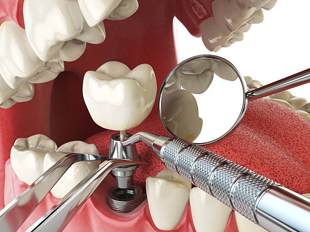 Best Broken or Cracked Tooth Emergency Dentist in Duncan Falls, OH